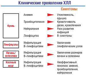 Клинические проявления хронического лимфолейкоза