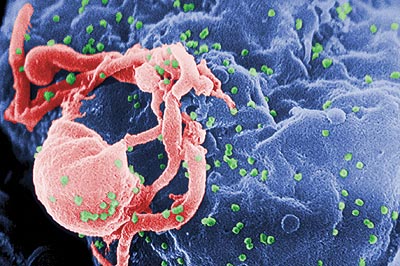 ВИЧ в электронном микроскопе