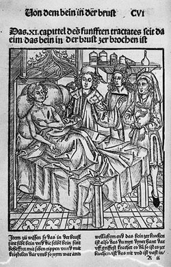 Иллюстрация из книги: Hieronymus Brunschwig «Dis ist das Buch der Cirurgie», Strasbourg, 1497