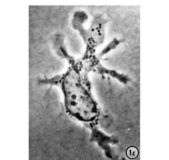  Фотография дендроцита, полученная  Р. Штейнманом в 1973 г. 