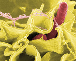 Распространенность резистентных бактерий продолжает расти