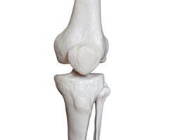Как укрепить кости и избавиться от остеопороза?