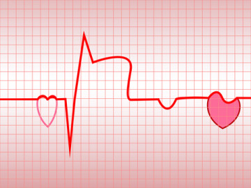 Сауна и риск развития сердечно-сосудистых заболеваний: есть ли связь?