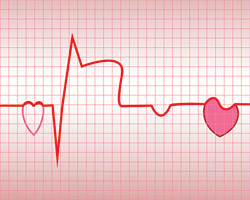 О чем может свидетельствовать повышение частоты сердечных сокращений?