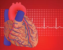 Заболевание суставов повышает риск возникновения инфаркта миокарда?