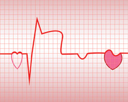 Какова взаимосвязь между ранним развитием менопаузы и нарушением ритма сердца?