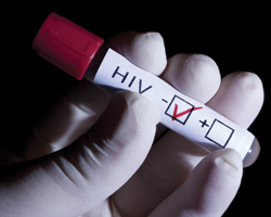 Как женщине защититьсяот ВИЧ?
