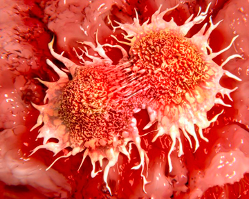 Как раковые клетки восстанавливают свои повреждения? | Щотижневик АПТЕКА